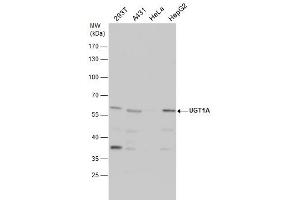 WB Image UGT1A antibody detects UGT1A protein by western blot analysis. (Ugt1 antibody)