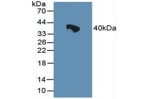 Detection of HSPBP1 in Rat Serum using Polyclonal Antibody to Heat Shock 70 kDa Binding Protein 1 (HSPBP1) (HSPBP1 antibody  (AA 198-352))