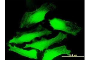 Immunofluorescence of purified MaxPab antibody to DNAJC5 on HeLa cell. (DNAJC5 antibody  (AA 1-198))