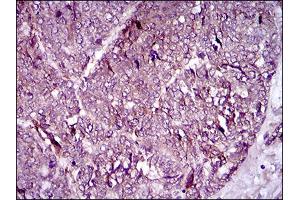 Immunohistochemistry (IHC) image for anti-Melanoma Cell Adhesion Molecule (MCAM) (AA 84-189) antibody (ABIN1724844)