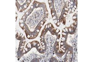 Immunohistochemical staining of human small intestine with SETD3 polyclonal antibody  shows strong cytoplasmic positivity with a granular pattern in glandular cells at 1:50-1:200 dilution. (SETD3 antibody)