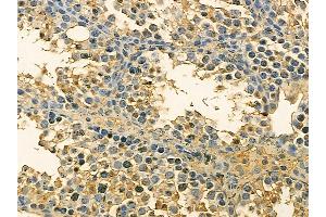 p23 Mouse Monoclonal Antibody at 1/100 staining mouse testis tissue by IHC-P.