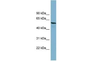 WB Suggested Anti-PGM3  Antibody Titration: 0.