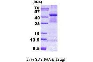 Figure annotation denotes ug of protein loaded and % gel used. (BUB3 Protein)