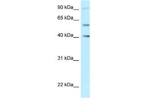 WB Suggested Anti-SHCBP1L Antibody Titration: 1. (SHCBP1L antibody  (C-Term))