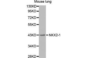 Western Blotting (WB) image for anti-NK2 Homeobox 1 (NKX2-1) antibody (ABIN1681058) (NKX2-1 antibody)