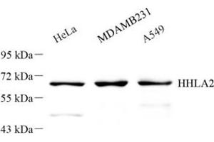Western blot analysis of HHLA2 (ABIN7074199) at dilution of 1: 300 (HHLA2 antibody)