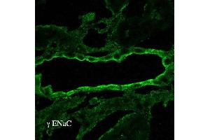 Immunohistochemistry analysis using Rabbit Anti-ENaC Polyclonal Antibody . (SCNN1A antibody  (AA 629-650) (APC))