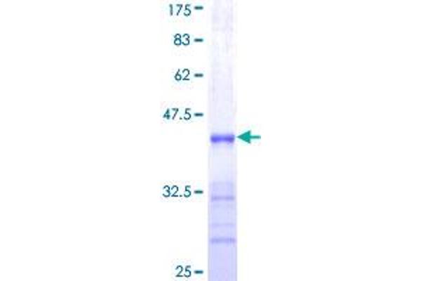 SHOX2 Protein (AA 117-204) (GST tag)