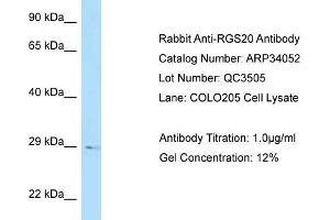 WB Suggested Anti-RGS20 Antibody   Titration: 1. (RGS20 antibody  (N-Term))