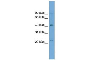 ATP8B2 antibody used at 1 ug/ml to detect target protein.