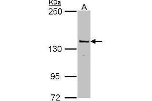 WB Image Sample (30 ug of whole cell lysate) A: MCF-7 5% SDS PAGE antibody diluted at 1:1000 (POLG antibody  (C-Term))