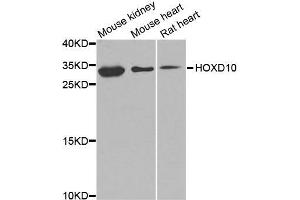Western blot analysis of extracts of various cell lines, using HOXD10 antibody (ABIN5974761) at 1/1000 dilution.