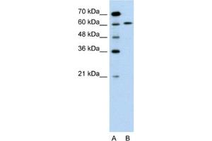 Western Blotting (WB) image for anti-Apoptosis-Inducing Factor, Mitochondrion-Associated, 1 (AIFM1) antibody (ABIN2463646) (AIF antibody)