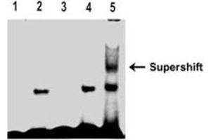Bioactivity measured with Activity Assay (RUNX1 Protein (Transcript Variant 2) (Myc-DYKDDDDK Tag))