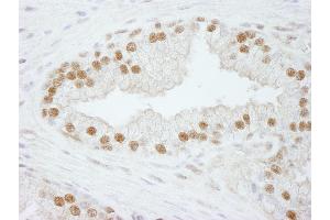 Immunohistochemistry (IHC) image for anti-Cleavage and Polyadenylation Specific Factor 3, 73kDa (CPSF3) (AA 634-684) antibody (ABIN7448486) (CPSF3 antibody  (AA 634-684))