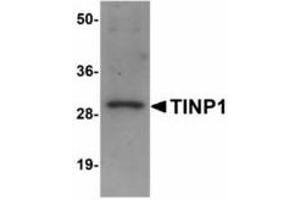 Image no. 1 for anti-NSA2 Ribosome Biogenesis Homolog (NSA2) (C-Term) antibody (ABIN478277)