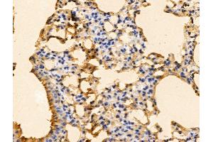 ABIN7094696 and ABIN7098747 at 1/100 staining Mouse lung tissue by IHC-P. (PFDN6 antibody  (N-Term))