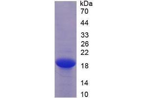 Image no. 1 for Endothelial Cell-Specific Molecule 1 (ESM1) (AA 20-184) (Active) protein (His tag) (ABIN6239900) (ESM1 Protein (AA 20-184) (His tag))