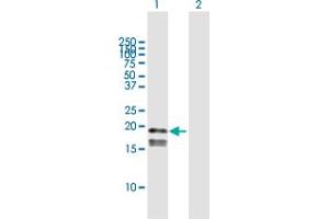 Western Blot analysis of GP9 expression in transfected 293T cell line by GP9 MaxPab polyclonal antibody. (CD42a antibody  (AA 1-177))
