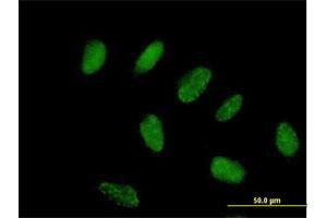 Immunofluorescence of purified MaxPab antibody to FLJ38288 on HeLa cell. (ZNF776 antibody  (AA 1-476))