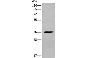 Western blot analysis of Mouse heart tissue lysate using MEDAG Polyclonal Antibody at dilution of 1:700 (MEDAG antibody)
