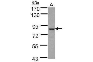 WB Image Sample (30 ug of whole cell lysate) A: A431 7. (BBS7 antibody)