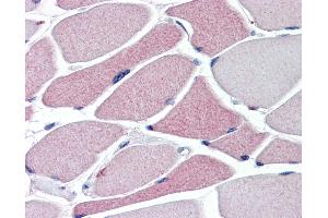 TRPA1 antibody (5 ug/ml) was used in IHC to stain formalin-fixed, paraffin-embedded human skeletal muscle, followed by biotinylated goat anti-rabbit IgG secondary antibody, alkaline phosphatase-streptavidin and chromogen. (TRPA1 antibody  (N-Term))