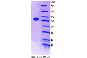 SDS-PAGE (SDS) image for Actinin, alpha 1 (ACTN1) (AA 28-260) protein (His tag) (ABIN6239061) (ACTN1 Protein (AA 28-260) (His tag))