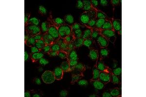 Immunohistochemistry (IHC) image for anti-Small Ubiquitin Related Modifier Protein 1 (SUMO1) antibody (ABIN6940847)
