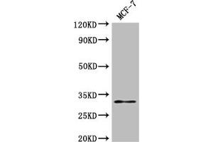 Western Blot Positive WB detected in: MCF-7 whole cell lysate All lanes: RSPH9 antibody at 1:2000 Secondary Goat polyclonal to rabbit IgG at 1/50000 dilution Predicted band size: 32, 35 kDa Observed band size: 32 kDa