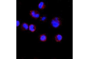 IF analysis of CD74 using anti-CD74 antibody (ABIN7603166). (CD74 antibody  (N-Term))