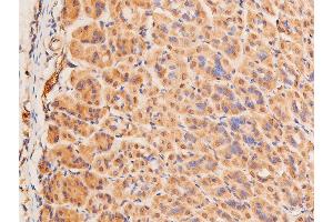 Immunohistochemistry (IHC) image for anti-Tumor Protein P53 (TP53) (pSer15) antibody (ABIN6256151)