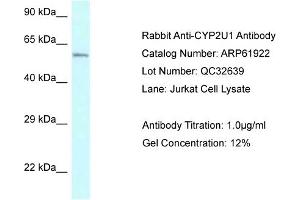 Western Blotting (WB) image for anti-Cytochrome P450, Family 2, Subfamily U, Polypeptide 1 (CYP2U1) (Middle Region) antibody (ABIN2788950) (CYP2U1 antibody  (Middle Region))