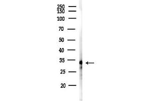 anti-A Kinase (PRKA) Anchor Protein 1 (AKAP1) (Internal Region) antibody
