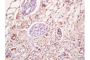 Formalin-fixed and paraffin embedded human kidney labeled with Anti-WNT4 Polyclonal Antibody, Unconjugated (ABIN762911) at 1:200 followed by conjugation to the secondary antibody and DAB staining (WNT4 antibody  (AA 201-300))