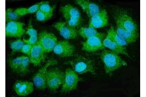 IF analysis of MTTP using anti-MTTP antibody (ABIN7601145). (MTTP antibody  (AA 29-702))