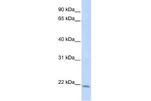 WB Suggested Anti-LIN7C Antibody Titration:  1 ug/ml  Positive Control:  HepG2 cell lysate