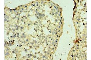 Immunohistochemistry of paraffin-embedded human testis tissue using ABIN7170478 at dilution of 1:100