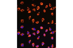 Immunofluorescence analysis of L929 cells using KIF21A Rabbit pAb (ABIN7268127) at dilution of 1:100. (KIF21A antibody  (AA 1070-1270))