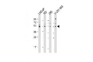 All lanes : Anti-OTUD3 Antibody (Center) at 1:2000 dilution Lane 1: LNCaP whole cell lysate Lane 2: RD whole cell lysate Lane 3: 293 whole cell lysate Lane 4: U-251 MG whole cell lysate Lysates/proteins at 20 μg per lane. (OTUD3 antibody  (AA 192-220))