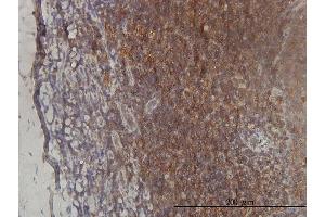 Immunoperoxidase of monoclonal antibody to ST3GAL2 on formalin-fixed paraffin-embedded human tonsil tissue. (ST3GAL2 antibody  (AA 28-127))