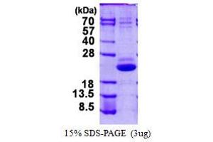 Vacuolar Protein-Sorting-Associated Protein 25 (VPS25) protein (His tag)