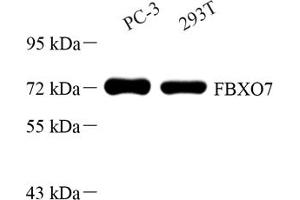 Western blot analysis of FBXO7 (ABIN7073906) at dilution of 1: 500 (FBXO7 antibody)