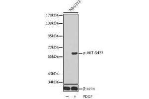 Western blot analysis of extracts from NIH/3T3 using Phospho-AKT(S473) Polyclonal Antibody. (AKT1 antibody  (pSer473))
