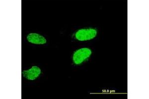 Image no. 1 for anti-Activating Transcription Factor 2 (ATF2) (AA 1-210) antibody (ABIN598626) (ATF2 antibody  (AA 1-210))