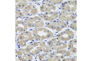 Immunohistochemistry of paraffin-embedded human stomach using HSD11B2 antibody (ABIN5995471) at dilution of 1/100 (40x lens). (HSD11B2 antibody)