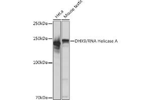 Western blot analysis of extracts of various cell lines, using DHX9/DHX9/RNA Helicase A Rabbit mAb (ABIN7265747) at 1:1000 dilution. (DHX9 antibody)