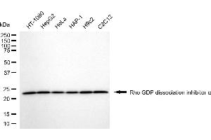 anti-rho GDP Dissociation Inhibitor (GDI) alpha (ARHGDIA) antibody