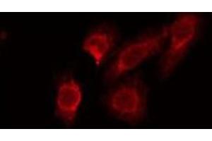 ABIN6275564 staining Hela by IF/ICC. (STAC2 antibody  (Internal Region))